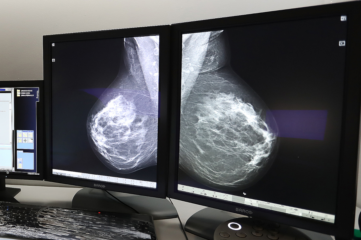 Controlli personalizzati per un rischio calcolato  